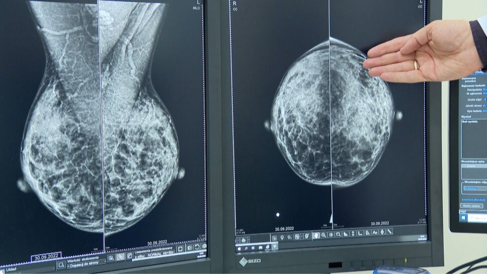 Październik miesiącem profilaktyki raka piersi. Lekarze zachęcają do bezpłatnych badań